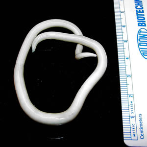 Tapeworm-CDC.jpeg