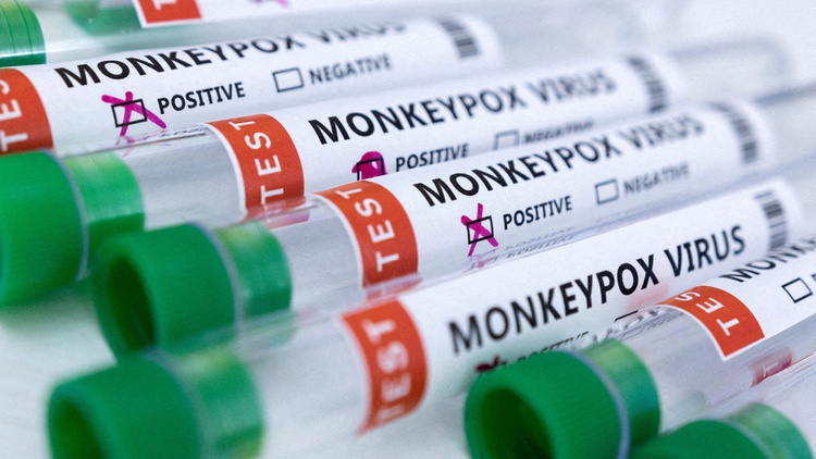 LA County has received some 7,000 monkeypox vaccine doses from the federal government. With COVID still spreading, can the public health system fight a second virus?