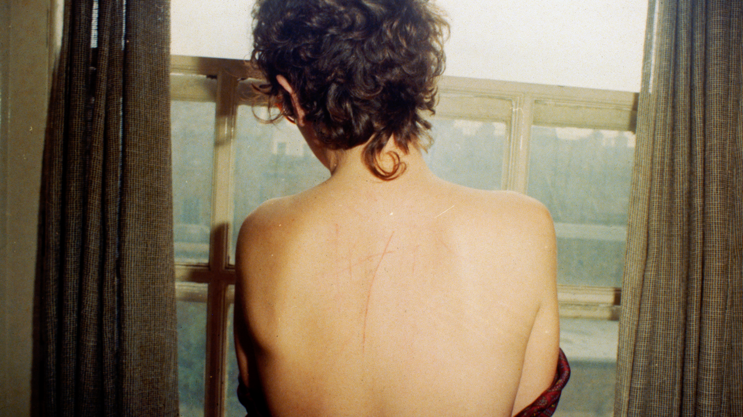 Nan Goldin’s self-portrait shows her scratched back after sex, London 1978. “[Nan Goldin] took the photographs both as a way to remind herself not to go back to the relationship, but that also people would see those photographs and be able to talk about domestic abuse. Society is very successful at placing shame … on people who are struggling, and yet the shame actually belongs someplace else,” says director Laura Poitras.