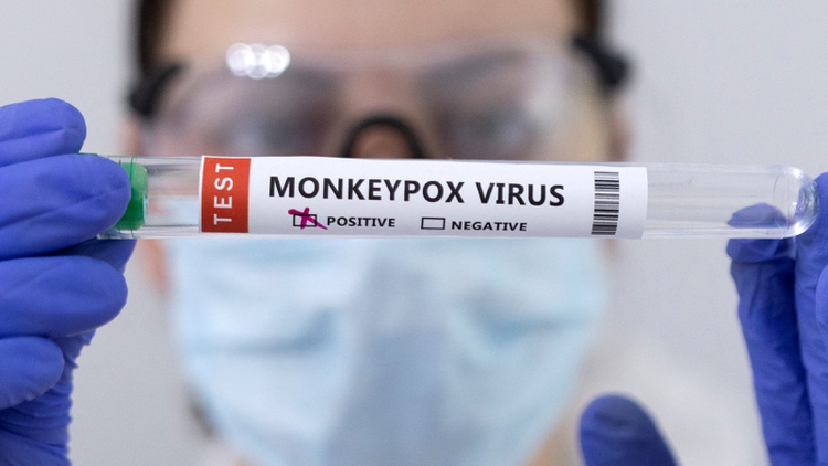 California has over 400 monkeypox cases, and tests and vaccines are tough to access.